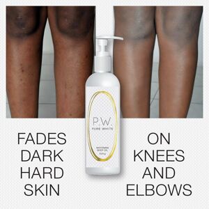 Pure White Whitening Body Oil Softens Fades Dark Hard Skin On Knees Elbows Pure White Whitening Body Oil Softens Fades Dark Hard Skin On Knees Elbows
