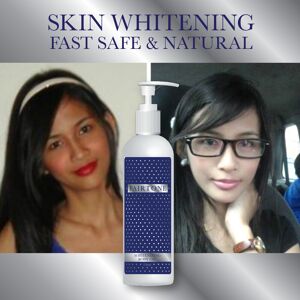Fairtone Whitenizing Body Oil Skin Whitening Fast Safe Natural Herbal Lighter Fairtone Whitenizing Body Oil Skin Whitening Fast Safe Natural Herbal Lighter