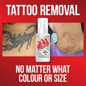 Inked Up Tattoo Fading Oil – Tattoo Removal No Matter What Colours Or Size Inked Up Tattoo Fading Oil – Tattoo Removal No Matter What Colours Or Size