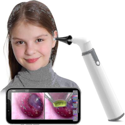 Unbranded Wireless Otoscope Ear Camera With Dual View, 3.9mm 720phd Wifi Ear Scope With 6 Unbranded Wireless Otoscope Ear Camera With Dual View, 3.9mm 720phd Wifi Ear Scope With 6