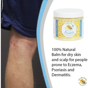 Ultra Bee Naturally Bee Beautiful 100% Natural Exeskin Balm 200ml - Soothes Dry Sensitive Skin and Dry Itchy Scalp Ultra Bee Naturally Bee Beautiful 100% Natural Exeskin Balm 200ml - Soothes Dry Sensitive Skin and Dry Itchy Scalp