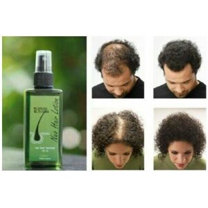 Neo Hair Lotion - Natural Treatment for Hair Loss - 120ml Neo Hair Lotion - Natural Treatment for Hair Loss - 120ml