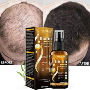 Unbranded Biotin Hair Growth Spray Anti Hair Loss Fast Regrowth Scalp Treatment Serum Unbranded Biotin Hair Growth Spray Anti Hair Loss Fast Regrowth Scalp Treatment Serum