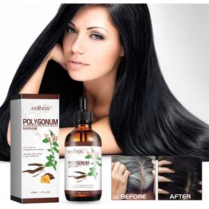 Unbranded Polygonum Multiflorum Oil Control, Anti-dandruff, Anti-itch, Anti-hair Loss Seru Unbranded Polygonum Multiflorum Oil Control, Anti-dandruff, Anti-itch, Anti-hair Loss Seru