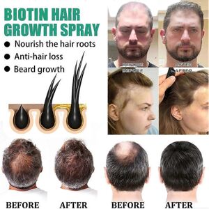 Unbranded Biotin Thicken Hair Oil Fast Growth Serum Anti Hair Break Baldness Hair Loss Tre Unbranded Biotin Thicken Hair Oil Fast Growth Serum Anti Hair Break Baldness Hair Loss Tre