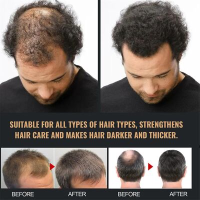 Unbranded Secret Hair Care Root Activator Shampoo - Stimulates Follicles, Promotes Growth Unbranded Secret Hair Care Root Activator Shampoo - Stimulates Follicles, Promotes Growth