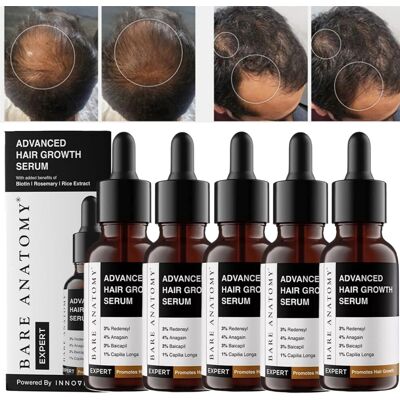 Unbranded 5X Bare Anatomy Advanced Hair Growth Serum - 30ml Unbranded 5X Bare Anatomy Advanced Hair Growth Serum - 30ml