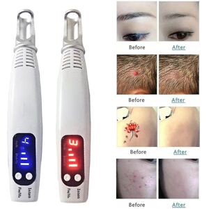 Unbranded Home Portable Picosecond Tattoo Removal Pen Fit For Mole Dark Spot Acne Scar Unbranded Home Portable Picosecond Tattoo Removal Pen Fit For Mole Dark Spot Acne Scar