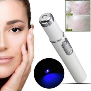 Unbranded Spider Vein Eraser Blue Light Therapy Wrinkle Acne Laser Pen Soft Scar Removal Unbranded Spider Vein Eraser Blue Light Therapy Wrinkle Acne Laser Pen Soft Scar Removal