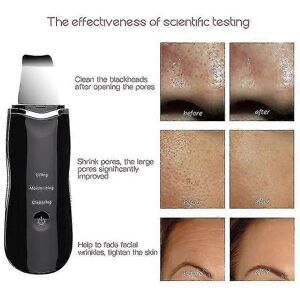 Kikidex (white, One size) Ultrasonic Skin Scrubber Deep Peeling Shovel Facial Pore Clean Kikidex (white, One size) Ultrasonic Skin Scrubber Deep Peeling Shovel Facial Pore Clean