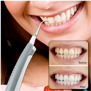 Unbranded Electric Ultrasonic Dental Scaler Tooth Calculus Remover Cleaner Unbranded Electric Ultrasonic Dental Scaler Tooth Calculus Remover Cleaner