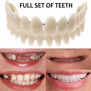 Unbranded Smile Snap-On Upper & Lower False Teeth Veneers - Realistic Resin Dentures Set f Unbranded Smile Snap-On Upper & Lower False Teeth Veneers - Realistic Resin Dentures Set f