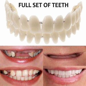 Unbranded Smile Snap-On False Teeth: Upper & Lower Natural-Looking Veneers Dentures - Resi Unbranded Smile Snap-On False Teeth: Upper & Lower Natural-Looking Veneers Dentures - Resi