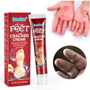 FLEMYE Cracked Hands and Feet Cream Anti-Frost Crack Cream FLEMYE Cracked Hands and Feet Cream Anti-Frost Crack Cream