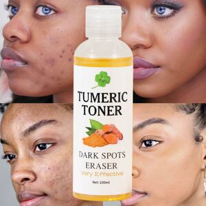Unbranded (Yellow) Dark Spots Eraser Turmeric Toner Skin Water Whitening Skin Whitening 10 Unbranded (Yellow) Dark Spots Eraser Turmeric Toner Skin Water Whitening Skin Whitening 10
