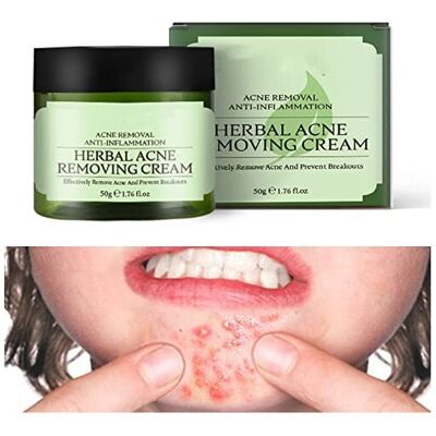 Tongyend Acne Cream,Moisturiser Face Cream Spot Cream Mens Moisturiser Tea Tree Cream Spo Tongyend Acne Cream,Moisturiser Face Cream Spot Cream Mens Moisturiser Tea Tree Cream Spo