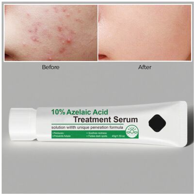 Unbranded (Multicolor) Azelaic Face Serum 12 Percent Azelaic Serum Against Redness Rosacea Unbranded (Multicolor) Azelaic Face Serum 12 Percent Azelaic Serum Against Redness Rosacea