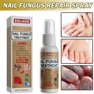 MDSRJONE 50 ml Anti Fungal Nail Treatment Repair Finger Toe Care Fungus Liquid Foot MDSRJONE 50 ml Anti Fungal Nail Treatment Repair Finger Toe Care Fungus Liquid Foot