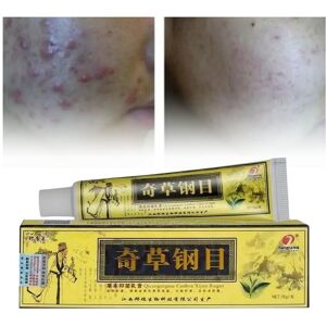 Unbranded Cream Antibacterial Herbal Treat Pimples Acne Eczema Elasticity Skin Restores Unbranded Cream Antibacterial Herbal Treat Pimples Acne Eczema Elasticity Skin Restores