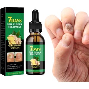 Unbranded Nail Fungal Essence Anti Infection Paronychia Ginger Onychomycosis Gel Unbranded Nail Fungal Essence Anti Infection Paronychia Ginger Onychomycosis Gel