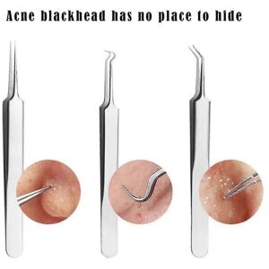 Unbranded Blackhead and Pimple Tweezers - 3 Types Available - Good Unbranded Blackhead and Pimple Tweezers - 3 Types Available - Good