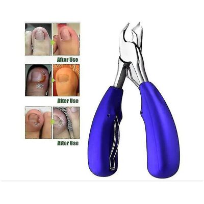 Unbranded Xox-professional Toenail Clippers For Thick Or Ingrown Toenails - Precision Nail Unbranded Xox-professional Toenail Clippers For Thick Or Ingrown Toenails - Precision Nail