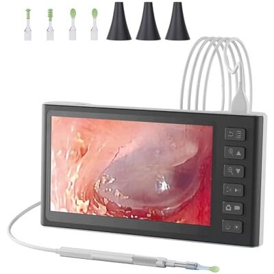 XINGLUOY Digital Otoscope with 7 Inch IPS Screen, 3.9mm Ear Wax Removal Tool Camera with 6 LED Lights, Visual Ear Camera and Wax Remover, Supports Photo Snap and Video Recording XINGLUOY Digital Otoscope with 7 Inch IPS Screen, 3.9mm Ear Wax Removal Tool Camera with 6 LED Lights, Visual Ear Camera and Wax Remover, Supports Photo Snap and Video Recording