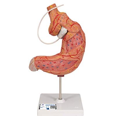 3B Scientific K15/1 Gastric Band Model + free Anatomy App 3B Smart Anatomy 3B Scientific K15/1 Gastric Band Model + free Anatomy App 3B Smart Anatomy