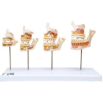 3B Scientific Human Anatomy – dental development + free app – 3B smart anatomy - Anatomy Model 3B Scientific Human Anatomy – dental development + free app – 3B smart anatomy - Anatomy Model