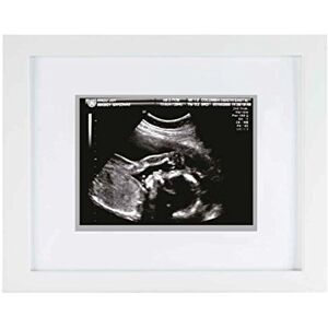 Pearhead Sonogram Keepsake Frame, Mothering Sunday Mother's Day Expecting or New Mum Gift, White Pearhead Sonogram Keepsake Frame, Mothering Sunday Mother's Day Expecting or New Mum Gift, White