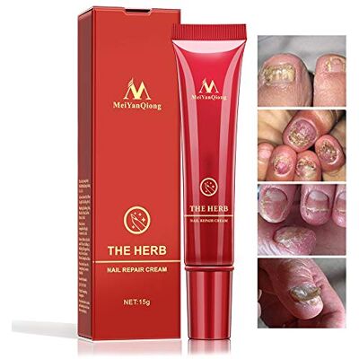 YALFEN Herbal Foot Nail Cream, Protector Skin Care Cream Ointment Treatment Toe Nail Onychomycosis Paronychia Anti Fungal Treatment Nail Repair Cream, 15g YALFEN Herbal Foot Nail Cream, Protector Skin Care Cream Ointment Treatment Toe Nail Onychomycosis Paronychia Anti Fungal Treatment Nail Repair Cream, 15g