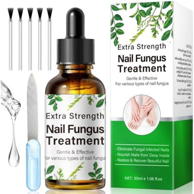 PawoFiity Fungal Nail Treatment Extra Strong for Toenails & Fingernails (30 ml) Effective Nail Fungus Treatment for Toenail, Toe Nail & Ingrown Toenail Treatment , for Thick Discoloured Brittle Nails PawoFiity Fungal Nail Treatment Extra Strong for Toenails & Fingernails (30 ml) Effective Nail Fungus Treatment for Toenail, Toe Nail & Ingrown Toenail Treatment , for Thick Discoloured Brittle Nails