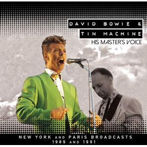 His Masters Voice: 2cd His Masters Voice: 2cd