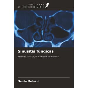 Meherzi, Samia Sinusitis fúngicas: Aspectos clínicos y tratamiento terapéutico Meherzi, Samia Sinusitis fúngicas: Aspectos clínicos y tratamiento terapéutico