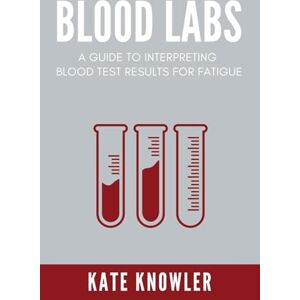 Knowler, Kate Blood Labs: Lab reference blood test book, and lab values interpretation for fatigue Knowler, Kate Blood Labs: Lab reference blood test book, and lab values interpretation for fatigue