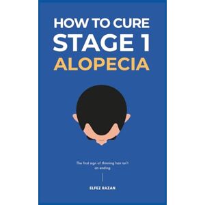 razan, Elfez How To Cure Stage 1 Alopecia: A Holistic, Science-Based Plan to Reverse Early-Stage Hair Loss, Restore Scalp Health, and Regrow Your Hair with Confidence (Hair Care) razan, Elfez How To Cure Stage 1 Alopecia: A Holistic, Science-Based Plan to Reverse Early-Stage Hair Loss, Restore Scalp Health, and Regrow Your Hair with Confidence (Hair Care)