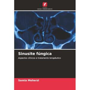 Meherzi, Samia Sinusite fúngica: Aspectos clínicos e tratamento terapêutico Meherzi, Samia Sinusite fúngica: Aspectos clínicos e tratamento terapêutico