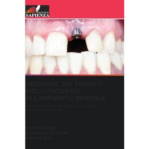 Gangil, Pankaj GESTIONE DEI TESSUTI MOLLI INTORNO ALL'IMPIANTO DENTALE: Gestione del biotipo gengivale sottile come procedura preimplantare Gangil, Pankaj GESTIONE DEI TESSUTI MOLLI INTORNO ALL'IMPIANTO DENTALE: Gestione del biotipo gengivale sottile come procedura preimplantare