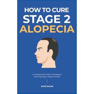 razan, Elfez How To Cure Stage 2 Alopecia: A Holistic Guide to Stop Hair Loss, Reduce Inflammation, and Regrow Your Hair with Proven Treatments, Diet, and Stress Management (Hair Care) razan, Elfez How To Cure Stage 2 Alopecia: A Holistic Guide to Stop Hair Loss, Reduce Inflammation, and Regrow Your Hair with Proven Treatments, Diet, and Stress Management (Hair Care)