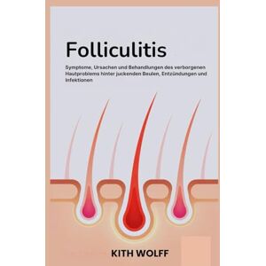 Wolff, Kith Folliculitis: Symptome, Ursachen, und Behandlungen des verborgenen Hautproblems hinter juckenden Beulen, Entzündungen und Infektionen Wolff, Kith Folliculitis: Symptome, Ursachen, und Behandlungen des verborgenen Hautproblems hinter juckenden Beulen, Entzündungen und Infektionen