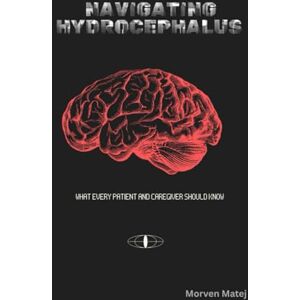 Matej, Morven Navigating Hydrocephalus: What Every Patient and Caregiver Should Know Matej, Morven Navigating Hydrocephalus: What Every Patient and Caregiver Should Know