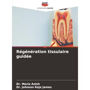 Anish, Dr. Maria Régénération tissulaire guidée Anish, Dr. Maria Régénération tissulaire guidée
