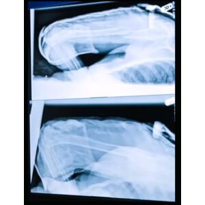 XAVIER PhD, DR MYA THE LEGAL SANCTITY OF MARRIAGE PARTS 11 <> 12: WHAT'S IN A BRUISE? XAVIER PhD, DR MYA THE LEGAL SANCTITY OF MARRIAGE PARTS 11 <> 12: WHAT'S IN A BRUISE?