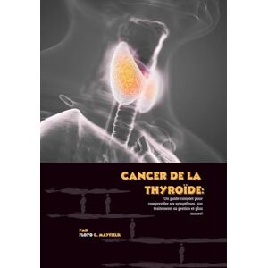 C. Mayfield, Floyd Cancer de la thyroïde: Un guide complet pour comprendre ses symptômes, son traitement, sa gestion et plus encore! C. Mayfield, Floyd Cancer de la thyroïde: Un guide complet pour comprendre ses symptômes, son traitement, sa gestion et plus encore!