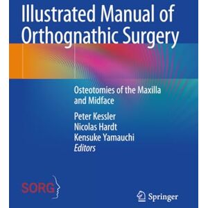 Illustrated Manual of Orthognathic Surgery: Osteotomies of the Maxilla and Midface Illustrated Manual of Orthognathic Surgery: Osteotomies of the Maxilla and Midface
