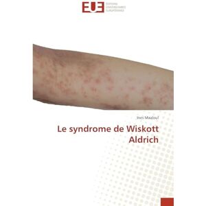 Maaloul, Ines Le syndrome de Wiskott Aldrich Maaloul, Ines Le syndrome de Wiskott Aldrich