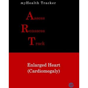 D'Souza, Albert E. myHealth Tracker Assess ▪ Reassess ▪ Track Enlarged Heart (Cardiomegaly) D'Souza, Albert E. myHealth Tracker Assess ▪ Reassess ▪ Track Enlarged Heart (Cardiomegaly)