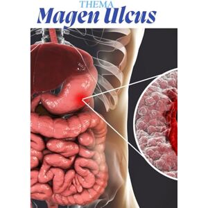 Pflegeleicht, Nadine Magen Ulcus kompakt – Pflegewissen für Auszubildende: Das einfache Kittelbuch: Definition, Ursachen, Symptome, Therapie, Pflege & Prophylaxe – mit ... Pflege – Die Kittelbuch-Reihe“) Pflegeleicht, Nadine Magen Ulcus kompakt – Pflegewissen für Auszubildende: Das einfache Kittelbuch: Definition, Ursachen, Symptome, Therapie, Pflege & Prophylaxe – mit ... Pflege – Die Kittelbuch-Reihe“)