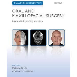 Challenging Concepts in Oral and Maxillofacial Surgery: Cases with Expert Commentary (Challenging Cases) Challenging Concepts in Oral and Maxillofacial Surgery: Cases with Expert Commentary (Challenging Cases)