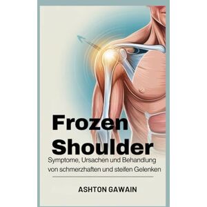 Ashton Frozen Shoulder: Symptome, Ursachen und Behandlung von schmerzhaften und steifen Gelenken Ashton Frozen Shoulder: Symptome, Ursachen und Behandlung von schmerzhaften und steifen Gelenken